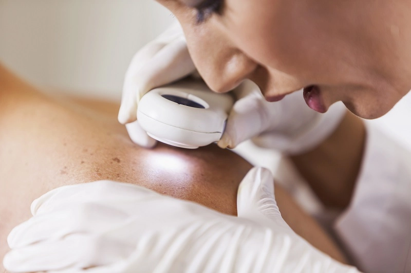 dermatolog bada skórę